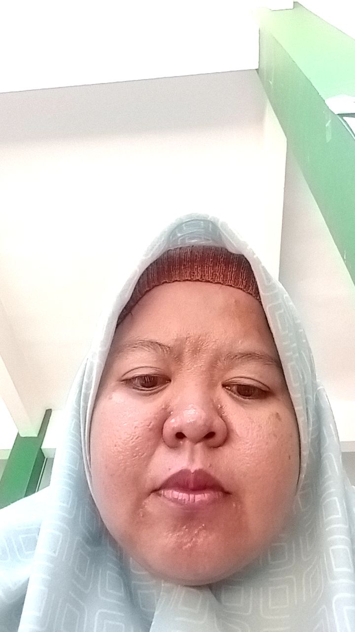 Selfie